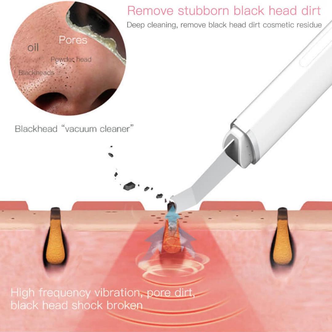 Face Blackhead Remover - Blush & Bloom