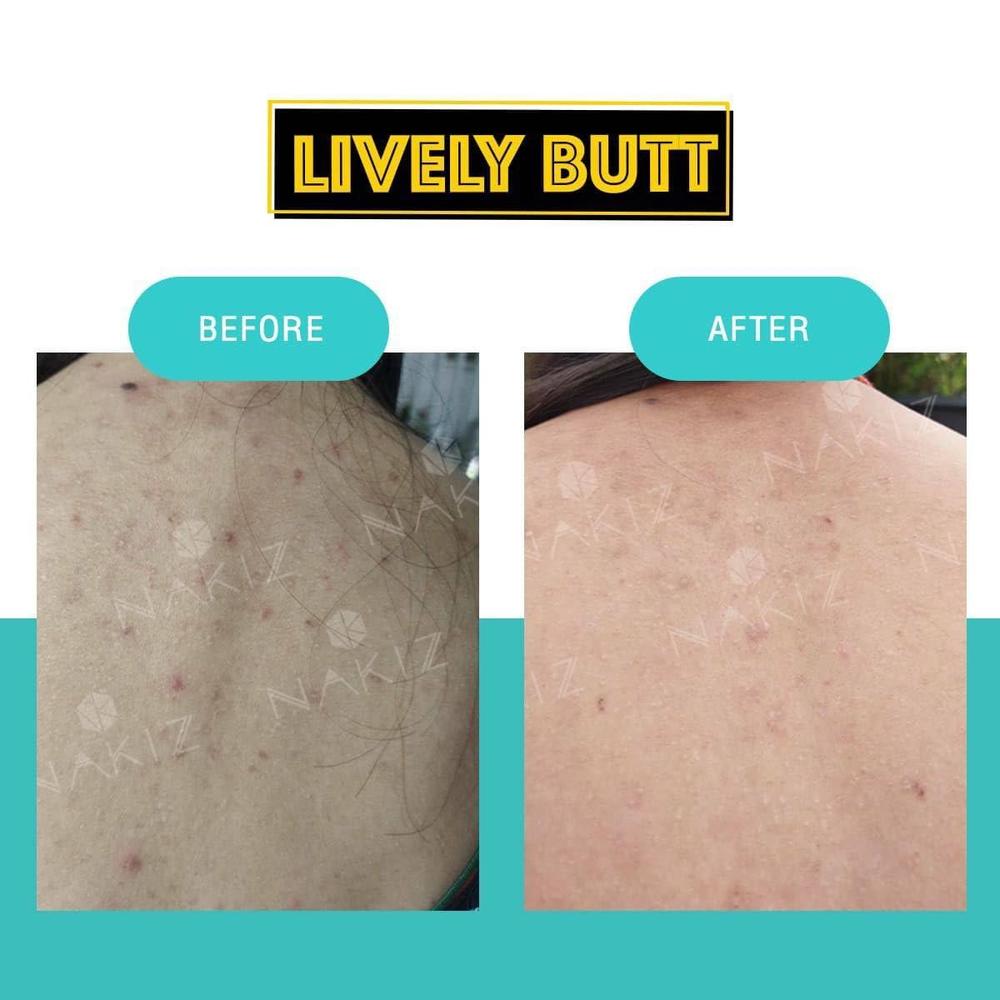 Nakiz Lively Butt Cream - Blush & Bloom